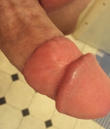 adult circed dicks 58e25bdd05edf.jpg