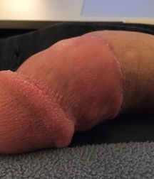 adult circed dicks 58e25bdf1d937.jpg