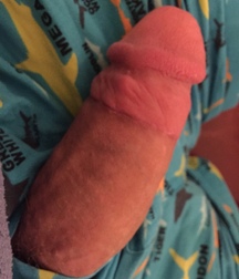 adult circed dicks 58e25be17d593.jpg