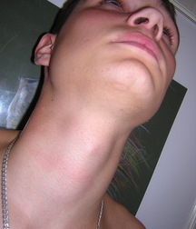 Surok 5890a8acc7b79.jpg