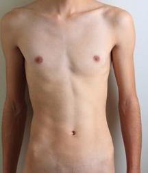 Mixed Boys 06 58bc45ab86f6f.jpg