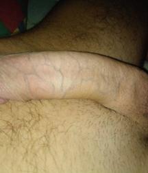 Young boy Paweł and his amazing cock 5870530c1bfc6.jpg