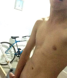zahnspange braces 58f8b20ecb284.jpg