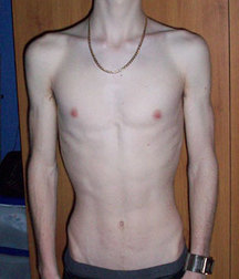 my album 58e1068f8dc62.jpg