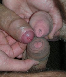 With Foreskin 5b81b4bed5522.jpg