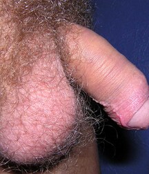 Hunter Gay Teen Porn 6245baa7f04bd.jpg