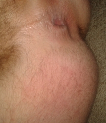 Boy Assholes 59301a7a1ebb8.jpg