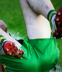 Irish gaa arses 5989b5f5ac4e9.jpg