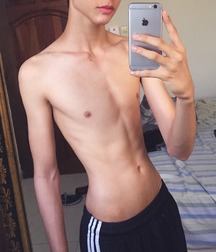 skinny twinks 1 59c98f4a0db2c.jpg