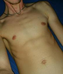 Naked German Boy 5a2e50a85cd6e.jpg
