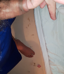 My little uncut dick 598be98c53d01.png