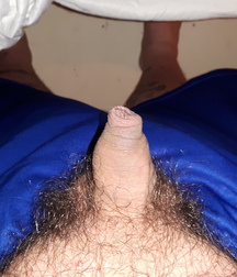My little uncut dick 598be9f8565aa.jpg