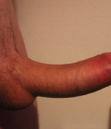 I want too suck this cocks 5a2e9a7b0dfea.png