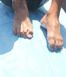 feets 59d9160f6706a.jpg