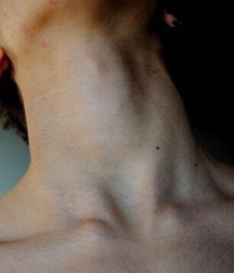 sensitive sex 5a55e5804fe18.jpg