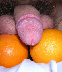Hard, Soft Or Moist 5c305ff06826a.jpg