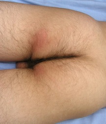 Marius Gay Boys Porn 61c70660c3fff.jpg