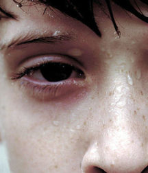 KissMe's Closeups 5a795c5e239df.jpg