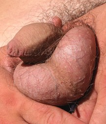 Penis, penis, penis 5a99978079797.jpg