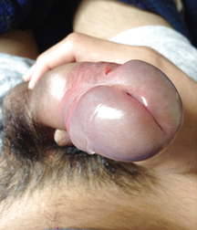 penises of different ages 01 5aa95cc15728a.jpg