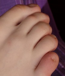 Jakub Boy Feet Teen 5a9a45d51de75.jpg