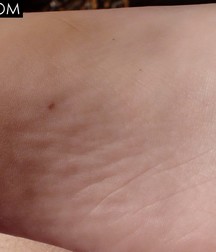 Jakub Boy Feet Teen 5a9a4601dc565.jpg