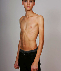 Skinny Twinks 13 :) 5ad6905675bcb.jpg