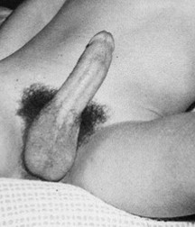 Culture Pubes 5ba8a80325584.jpg