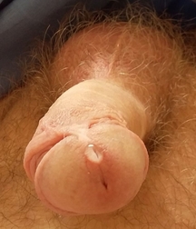 The penis 5dc42785e72b0.jpg