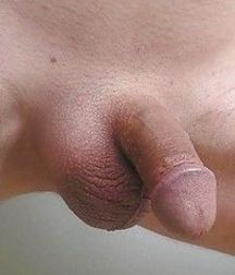The penis 5dc427bbd1655.jpg