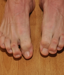Milosz Feet Solo 1 5bd42a578a63c.jpg