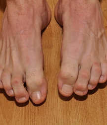 Milosz Feet Solo 1 5bd42a5abc258.jpg