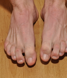 Milosz Feet Solo 1 5bd42a5d8301d.jpg