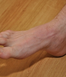 Milosz Feet Solo 1 5bd42a60160ee.jpg