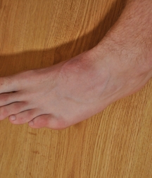 Milosz Feet Solo 1 5bd42a6ccae06.jpg