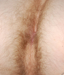 Pete 5d4d77646645e.jpg
