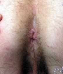 soldier's ass 5b6d3afac8a05.jpg