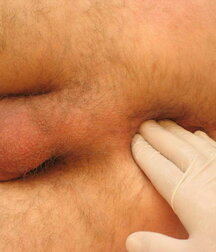 Soldier get his Christmas Medical check-up gay porn 61c7716dad7ed.jpg