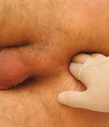Soldier get his Christmas Medical check-up gay porn 61c7716f8b328.jpg