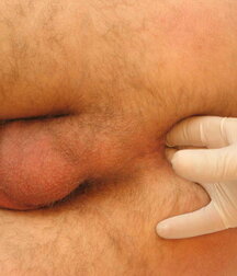 Soldier get his Christmas Medical check-up gay porn 61c771756bf4b.jpg