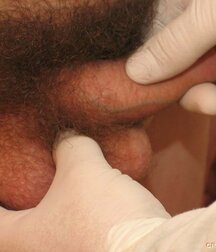 Doctor games with young twink porn 61c776b044da0.jpg