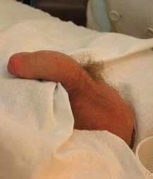 Doctor games with young twink porn 61c7774625af8.jpg