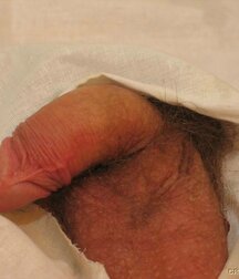 Doctor games with young twink porn 61c7775d20e8c.jpg