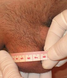 Sweet boy gets anal control and sperm extraction porn 61da0ce2648f4.jpg