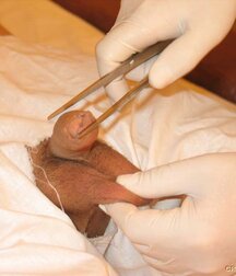 Sweet boy gets anal control and sperm extraction porn 61da0d82ce17b.jpg