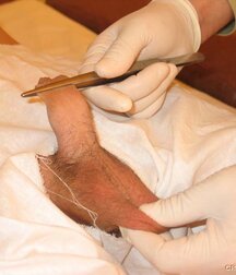 Sweet boy gets anal control and sperm extraction porn 61da0d84b8abf.jpg