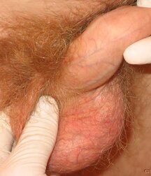 Twink gets medical checkup gay porn 61e1d69b3bf7c.jpg