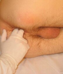 Twink gets medical checkup gay porn 61e1d6e765e50.jpg