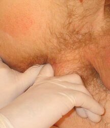 Twink gets medical checkup gay porn 61e1d6ef5d2ea.jpg
