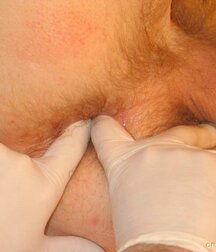 Twink gets medical checkup gay porn 61e1d6f15ecc1.jpg